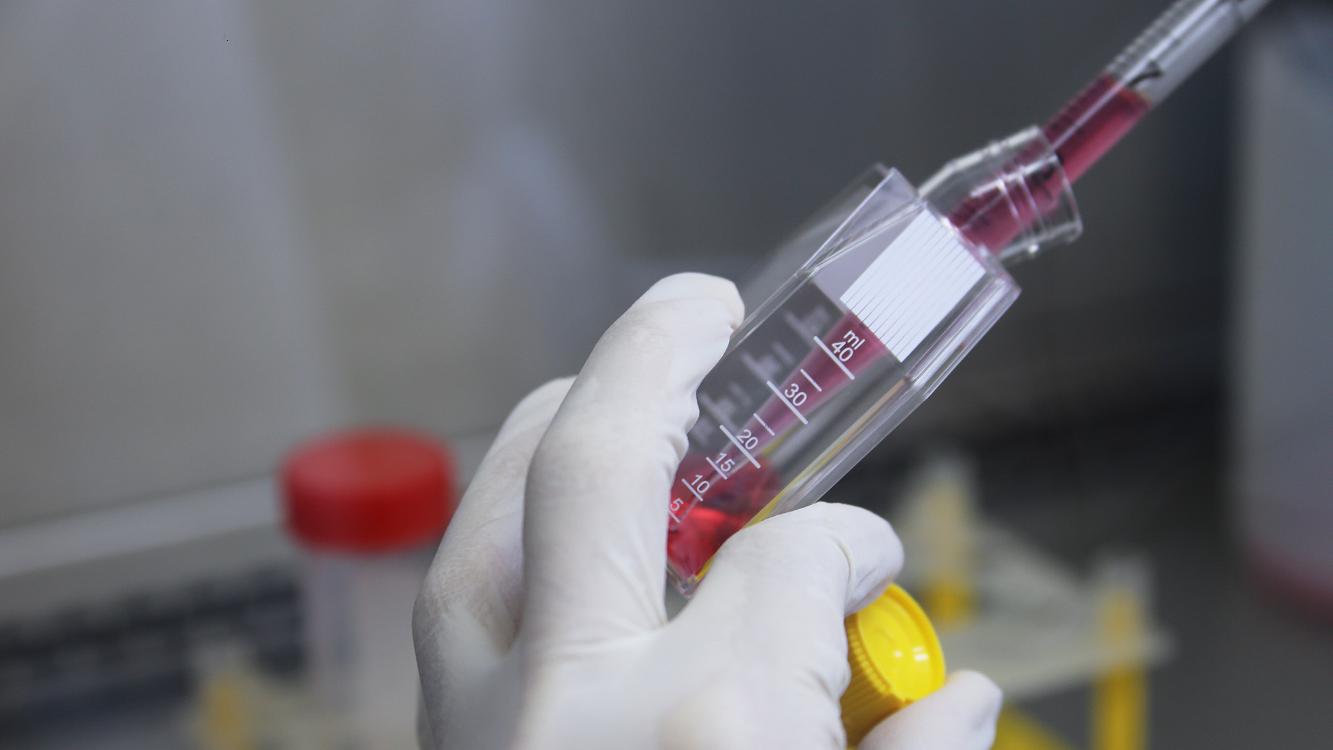 Vacina contra Covid-19 feita por empresa brasileira e companhia americana ganha apoio da Anvisa para submeter dados não clínicos para análise 1 Vacina contra Covid 19 feita por empresa brasileira e companhia americana ganha apoio da Anvisa para submeter dados não clínicos para análise