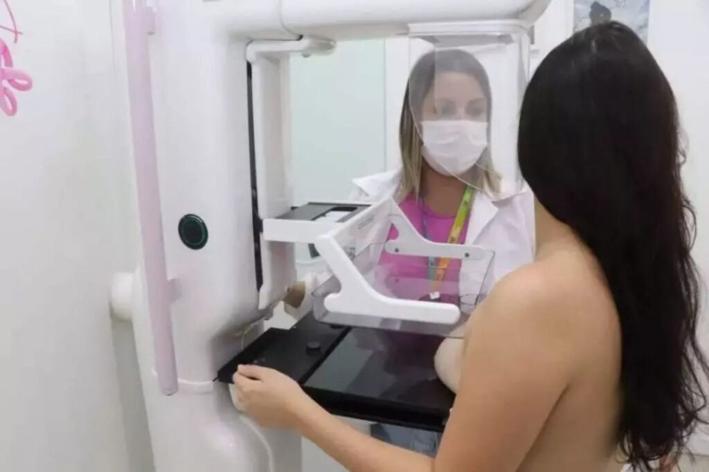 CAISM de Ribeirão Pires abre as portas para livre demanda de mamografia 